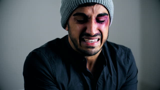 portrait-of-Young-man-beaten-and-wounded-cries-looking-at-the-camera