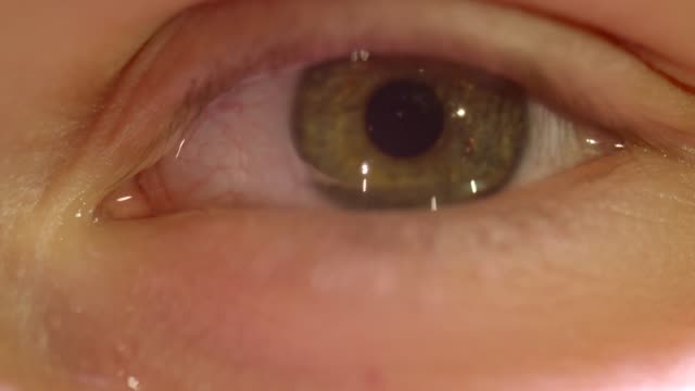 Close-up-shoot-of-peson-with-green-eye-blinks-fastly-with-tears-falling-being-depressed-and-sad-watching-into-camera.