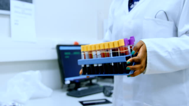 Labortechniker-tragen-Blut-Proben-Rack-4k