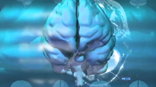 menschliche-medizinische-Anatomie-des-Gehirns