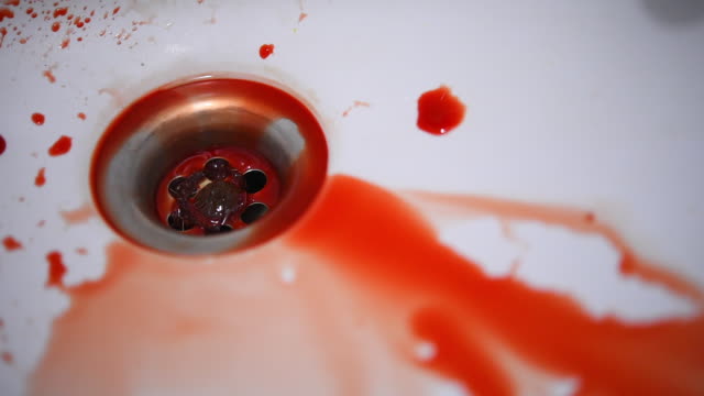 Tropfen-von-Blut-befleckt-am-Waschbecken