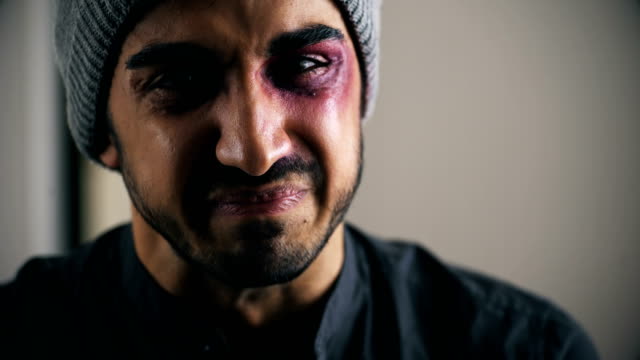Young-man-beaten-and-wounded-cries-looking-at-the-camera,close-up
