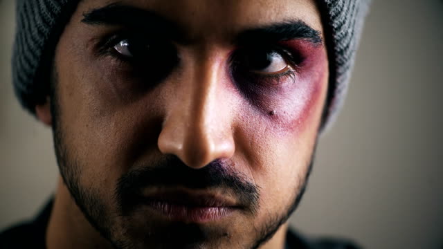 beaten-and-wounded-young-man-staring-at-the-camera,close-up
