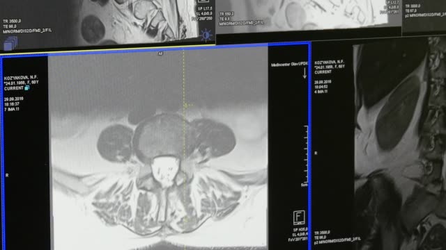 Médula-espinal-y-columna-vertebral-tomografía-de-resonancia-magnética.