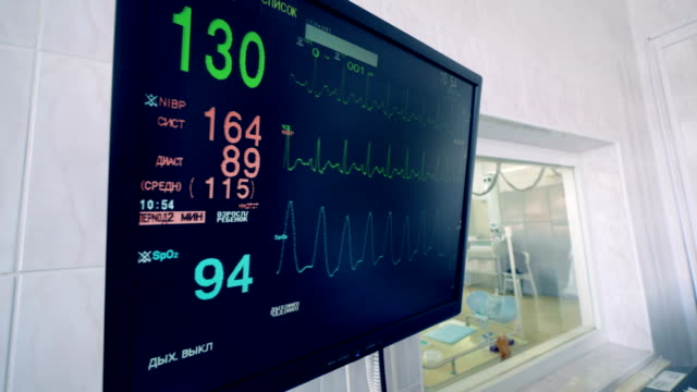 Medizinischer-Geräte-zeigt-Herzfrequenz-des-Patienten-während-einer-Operation.-4K.