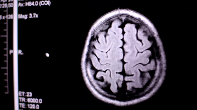 Blick-auf-Computer-Bildschirm-beim-Patienten-bewegt-sich-in-MRT-Gerät-Arzt,-analysiert-der-Arzt-die-Ergebnisse-der-Kernspintomographie-auf-seinem-Laptop.-4k,-Hintergrund-unscharf