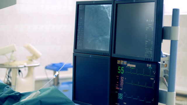 Especial-de-la-cámara-muestra-el-corazón-en-un-monitor-durante-una-cirugía.-4K.