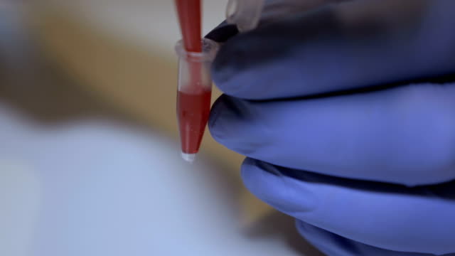 Técnico-de-laboratorio-manteniendo-la-pipeta-y-muestras-de-sangre-en-sala-del-hospital-para-transfusión-de-sangre,-las-manos-cerca-para-arriba.-Closeup-de-médico-sosteniendo-el-tubo-de-ensayo-de-la-sangre.-SIDA-/-VIH-Hospital-prueba-de-sangre.