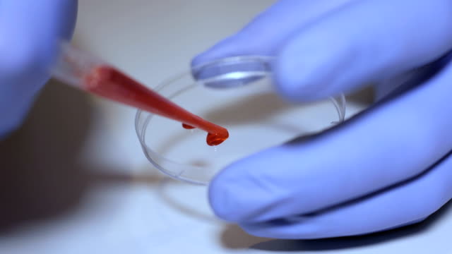 Laborantin-holding-Pipette-und-testen-Blutproben-auf-Krankenstation-für-Bluttransfusion,-Hände-schließen-sich.-Nahaufnahme-des-Arztes-hält-Reagenzglas-des-Blutes.-AIDS-/-HIV-Krankenhaus-Blut-Test.