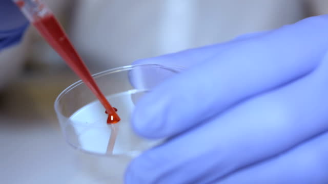 Lab-technician-holding-pipette-and-testing-blood-samples-on-hospital-ward-for-blood-transfusion,-hands-close-up.-Closeup-of-doctor-holding-test-tube-of-blood.-AIDS-/-HIV-Hospital-blood-test.