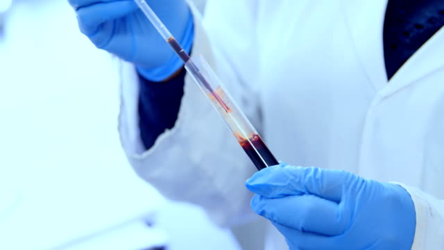 Arzt-Tests-Blutprobe-in-Blutbank-4k