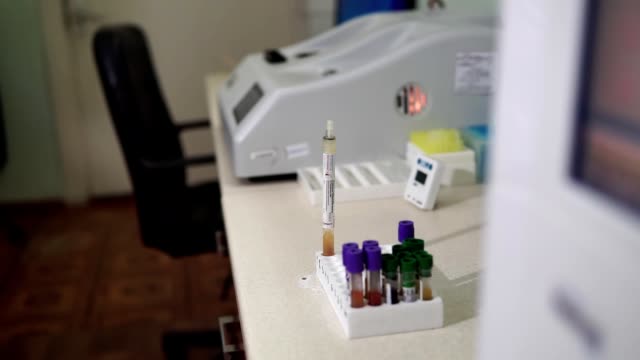 Una-asistente-de-laboratorio-está-preparando-análisis-de-sangre.-Tecnología-médica-moderna.-Laboratorio-Mtdicinal.
