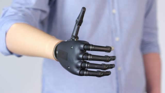 Showing-Thumbs-Up-with-Prosthetic-Hand
