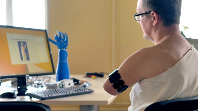 Man-with-the-amputated-arm-using-computer-with-wireless-bionic-sensors.-4K.