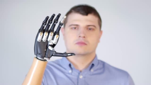 Man-with-Prosthetic-Arm