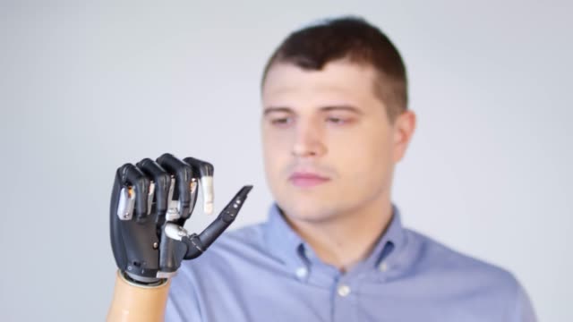 Amputado-hombre-moviendo-los-dedos-en-el-brazo-protésico