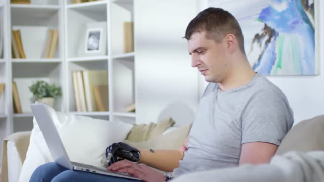 Mann-mit-künstlichem-Arm-arbeitet-auf-Laptop