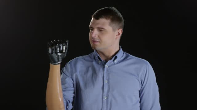 Hombre-amputado-prueba-movilidad-del-brazo-protésico