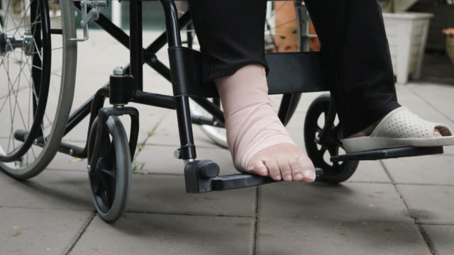 Paciente-con-la-pierna-rota-en-silla-de-ruedas-en-el-hospital