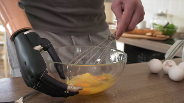 Behinderter-Mann-mit-bionischen-Arm-Peitscheneier-in-Glasschüssel