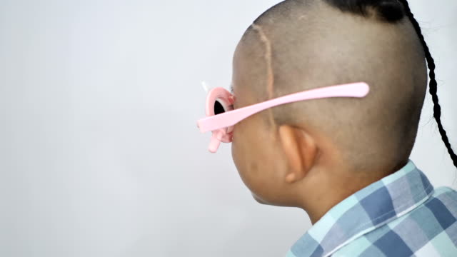 eyesight-check.-Asian-boys-who-have-vision-disabilities.-Left-eye-is-not-visible-from-brain-surgery.-Medical-treatment-and-Rehabilitation.-video-4k