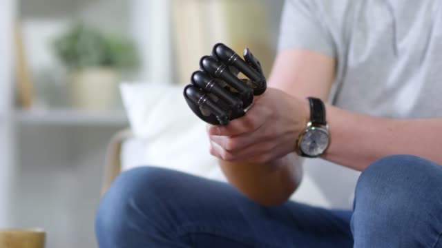 Disabled-Man-Putting-on-Prosthetic-Arm