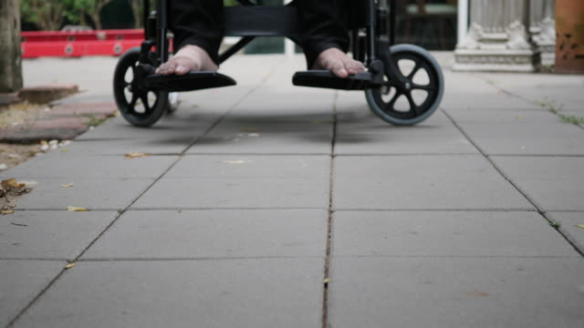 Patient-with-broken-leg-on-wheelchair-in-hospital