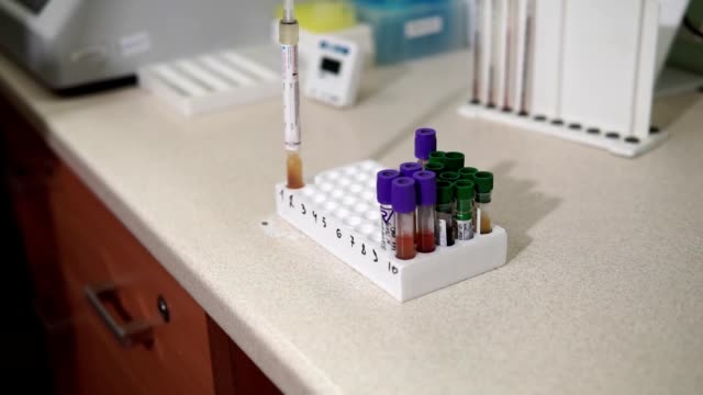 A-female-lab-assistant-is-preparing-blood-tests.-Modern-medical-technology.-Mtdicinal-lab.