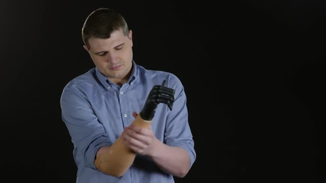 Amputado-hombre-guarnición-nuevo-brazo-protésico