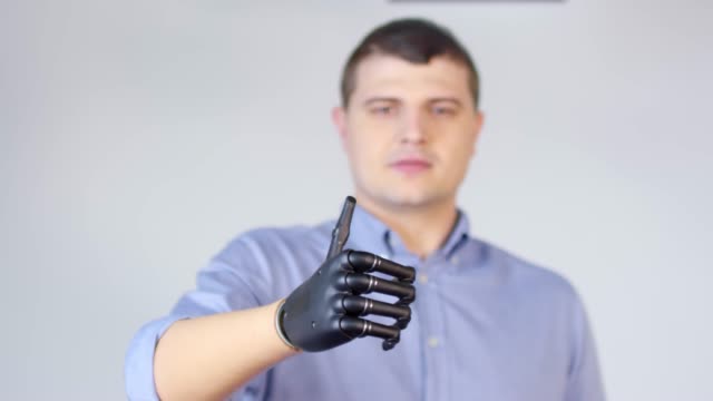 Man-with-Prosthetic-Arm-Showing-Thumbs-Up
