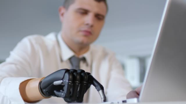 Empresario-con-el-mecanografiar-artificial-del-brazo-en-el-ordenador-portátil