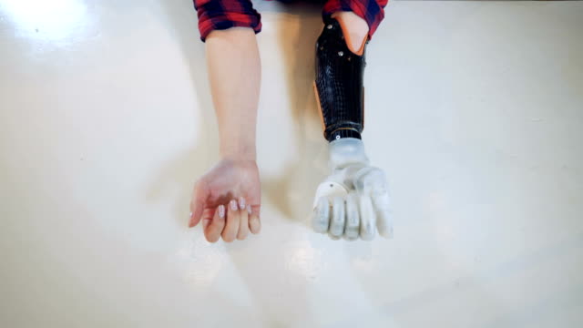 Behinderte-Frau-verwendet-eine-bionische-Hand,-Top-Ansicht.