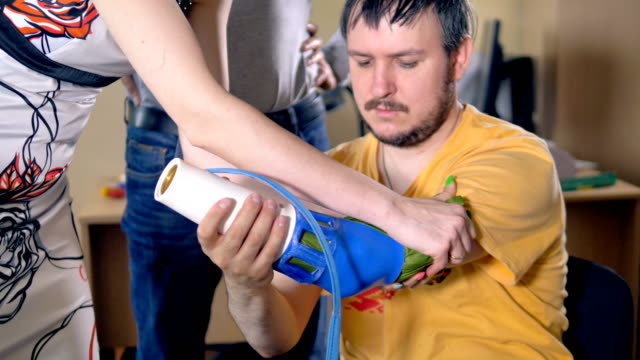 Setting-artificial-limb-on-the-amputated-hand.