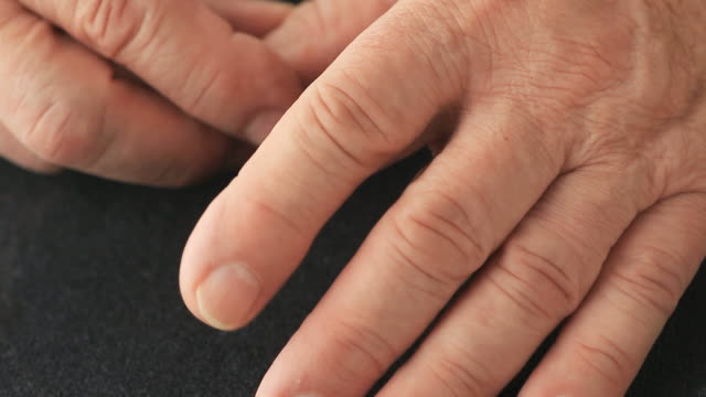 Closeup-of-man-with-finger-tremor