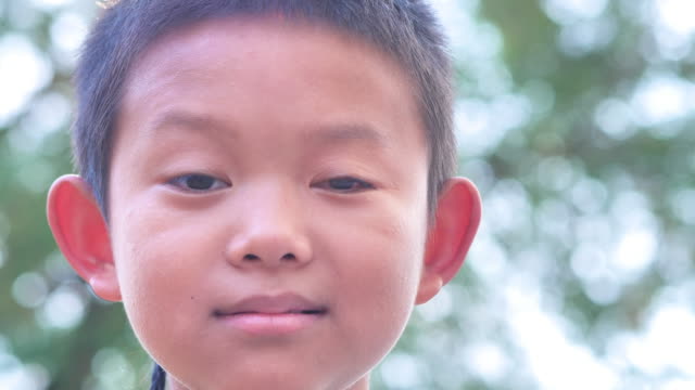 Close-up-face-of-asian-Boy.-The-left-eye-is-invisible-disabilities.--Slow-Motion