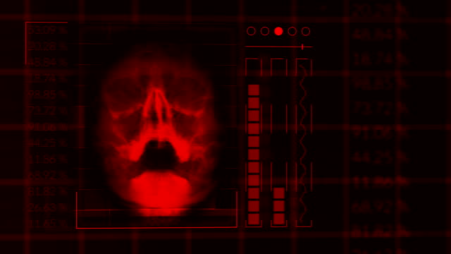 Análisis-de-un-cráneo-humano,-hud-de-lazo-rojo-interfaz-equipos-médicos