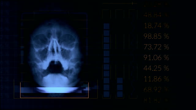 Análisis-de-un-cráneo-humano,-bucle-azul-equipo-médico-de-la-interfaz-de-hud