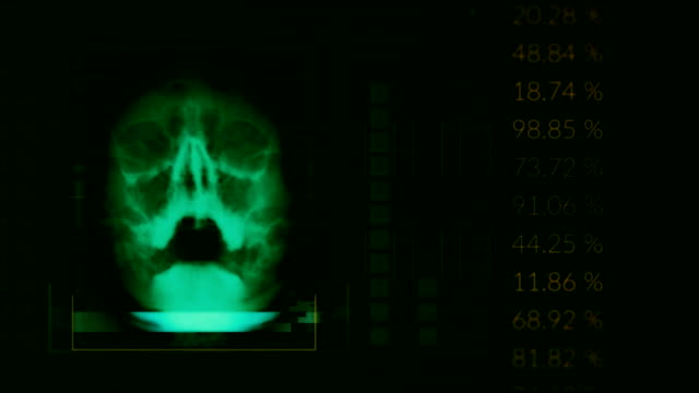 Scan-of-a-human-skull,-looped-Green-hud-interface-medical-equipment