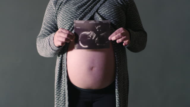 Mutterschaft-Ultraschall-Foto-Frau-mit-Bild-vor-Bauch-Baby-Bauch