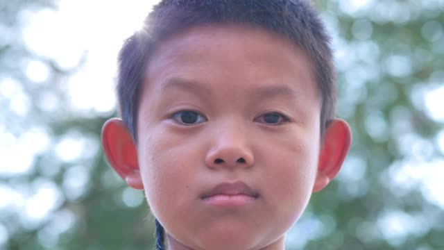 Close-up-face-of-asian-Boy.-The-left-eye-is-invisible-disabilities.--Slow-Motion