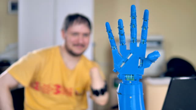 Bionische-Hand-bewegen-und-der-Mann-mit-der-Amputierten-Hand-steuert.