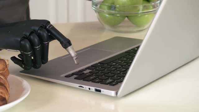 Unkenntlich-amputierter-Amputierter-mit-Bionic-Wrist-Typing-auf-Laptop