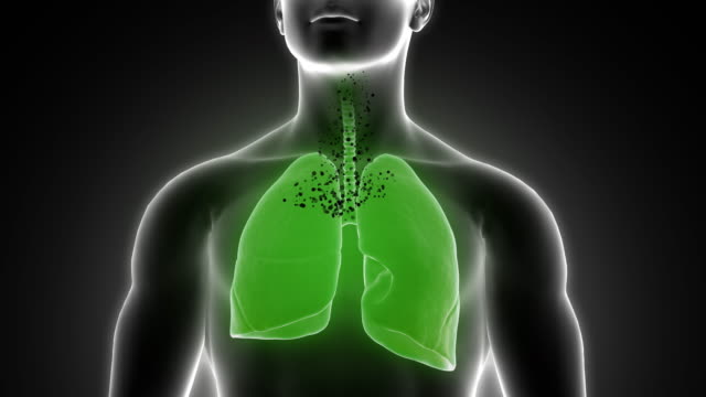 Hochwertige-Aufnahmen-einer-menschlichen-Lunge-wurden-beschädigt