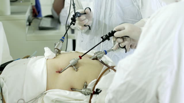 4K-The-team-of-medical-specialists-conducted-laparoscopic-surgery.