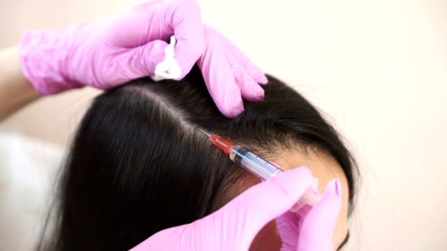 Cosmetologist-makes-injections-into-the-scalp.