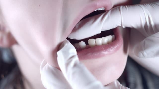 4k-schließen-sich-Kind-Arzt-zeigt-Zähne-wackeln