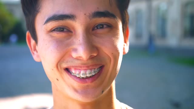 Beautiful-asian-happy-boy-is-laughing-in-braces-and-looking-aside,-while-standing-on-the-street