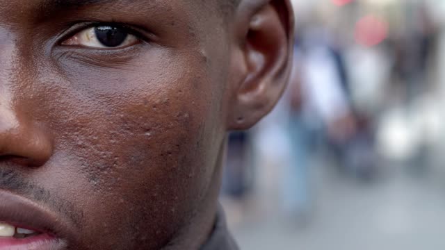 young-black-immigrant-staring-at-camera--half-face--outdoor--slow-motion