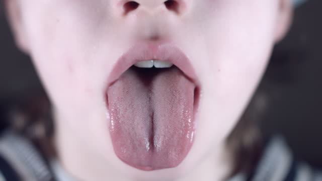 4k-Close-Up-Child-Showing-his-Tongue-to-Doctor