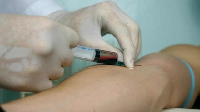 Male-nurse-takes-a-blood-sample-for-tests.-Hand-of-doctor-injects-a-syringe-into-a-vein-of-patient.-Arm-of-medic-taking-blood.-Close-up-Side-view